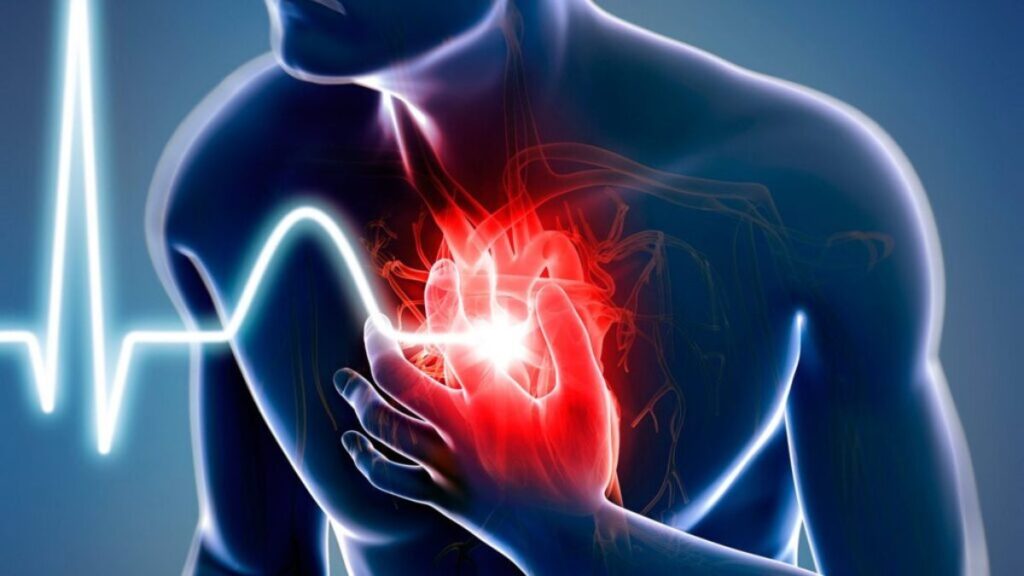 Heart Attack
