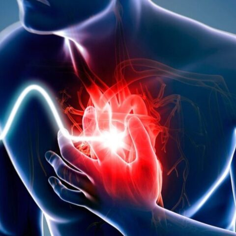 Heart Attack