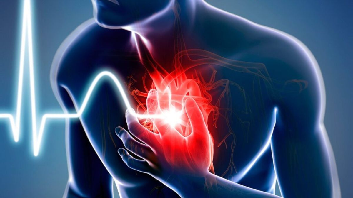 Heart Attack
