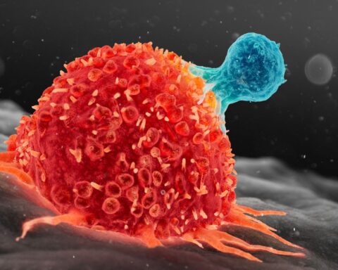 Scientists Find New Way to Supercharge Cancer-Fighting Cells