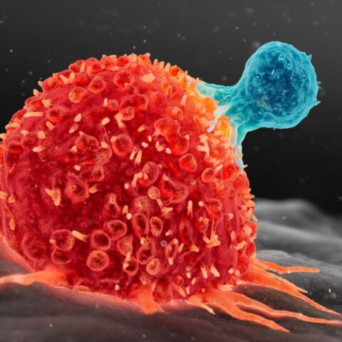 Scientists Find New Way to Supercharge Cancer-Fighting Cells