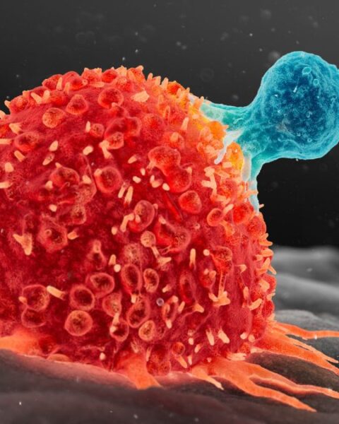 Scientists Find New Way to Supercharge Cancer-Fighting Cells