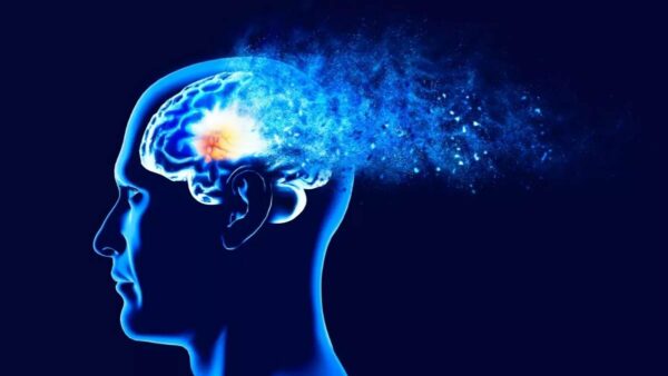 Alzheimers disease or dementia